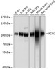 Western blot analysis of extracts of various cell lines, using ACO2 antibody (19-131) at 1:1000 dilution.<br/>Secondary antibody: HRP Goat Anti-Rabbit IgG (H+L) at 1:10000 dilution.<br/>Lysates/proteins: 25ug per lane.<br/>Blocking buffer: 3% nonfat dry milk in TBST.<br/>Detection: ECL Basic Kit.<br/>Exposure time: 5s.