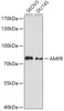 Western blot analysis of extracts of various cell lines, using AMFR antibody (19-138) at 1:1000 dilution.<br/>Secondary antibody: HRP Goat Anti-Rabbit IgG (H+L) at 1:10000 dilution.<br/>Lysates/proteins: 25ug per lane.<br/>Blocking buffer: 3% nonfat dry milk in TBST.<br/>Detection: ECL Basic Kit.<br/>Exposure time: 30s.