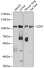 Western blot analysis of extracts of various cell lines, using CD97 antibody (19-157) at 1:1000 dilution.<br/>Secondary antibody: HRP Goat Anti-Rabbit IgG (H+L) at 1:10000 dilution.<br/>Lysates/proteins: 25ug per lane.<br/>Blocking buffer: 3% nonfat dry milk in TBST.<br/>Detection: ECL Basic Kit.<br/>Exposure time: 90s.