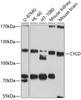 Western blot analysis of extracts of various cell lines, using CYLD antibody (19-172) at 1:1000 dilution.<br/>Secondary antibody: HRP Goat Anti-Rabbit IgG (H+L) at 1:10000 dilution.<br/>Lysates/proteins: 25ug per lane.<br/>Blocking buffer: 3% nonfat dry milk in TBST.<br/>Detection: ECL Basic Kit.<br/>Exposure time: 90s.