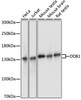 Western blot analysis of extracts of various cell lines, using DDB1 antibody (19-176) at 1:3000 dilution.<br/>Secondary antibody: HRP Goat Anti-Rabbit IgG (H+L) at 1:10000 dilution.<br/>Lysates/proteins: 25ug per lane.<br/>Blocking buffer: 3% nonfat dry milk in TBST.<br/>Detection: ECL Basic Kit.<br/>Exposure time: 1s.