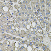 Immunohistochemistry of paraffin-embedded human liver damage using GFPT1 antibody (19-196) at dilution of 1:100 (40x lens) .