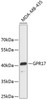 Western blot analysis of extracts of MDA-MB-435 cells, using GPR17 antibody (19-203) .<br/>Secondary antibody: HRP Goat Anti-Rabbit IgG (H+L) at 1:10000 dilution.<br/>Lysates/proteins: 25ug per lane.<br/>Blocking buffer: 3% nonfat dry milk in TBST.