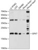 Western blot analysis of extracts of various cell lines, using GPX7 antibody (19-205) at 1:1000 dilution.<br/>Secondary antibody: HRP Goat Anti-Rabbit IgG (H+L) at 1:10000 dilution.<br/>Lysates/proteins: 25ug per lane.<br/>Blocking buffer: 3% nonfat dry milk in TBST.<br/>Detection: ECL Basic Kit.<br/>Exposure time: 30s.