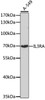 Western blot analysis of extracts of A-549 cells, using IL3RA antibody (19-217) at 1:1000 dilution.<br/>Secondary antibody: HRP Goat Anti-Rabbit IgG (H+L) at 1:10000 dilution.<br/>Lysates/proteins: 25ug per lane.<br/>Blocking buffer: 3% nonfat dry milk in TBST.<br/>Detection: ECL Basic Kit.<br/>Exposure time: 90s.