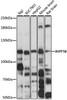 Western blot analysis of extracts of various cell lines, using INPP5B antibody (19-218) at 1:3000 dilution.<br/>Secondary antibody: HRP Goat Anti-Rabbit IgG (H+L) at 1:10000 dilution.<br/>Lysates/proteins: 25ug per lane.<br/>Blocking buffer: 3% nonfat dry milk in TBST.<br/>Detection: ECL Basic Kit.<br/>Exposure time: 15s.