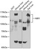 Western blot analysis of extracts of various cell lines, using NBR1 antibody (19-224) at 1:1000 dilution.<br/>Secondary antibody: HRP Goat Anti-Rabbit IgG (H+L) at 1:10000 dilution.<br/>Lysates/proteins: 25ug per lane.<br/>Blocking buffer: 3% nonfat dry milk in TBST.<br/>Detection: ECL Basic Kit.<br/>Exposure time: 90s.