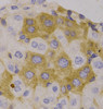 Immunohistochemistry of paraffin-embedded human liver, using NBR1 antibody (19-224) .