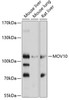 Western blot analysis of extracts of various cell lines, using MOV10 antibody (19-231) at 1:1000 dilution.<br/>Secondary antibody: HRP Goat Anti-Rabbit IgG (H+L) at 1:10000 dilution.<br/>Lysates/proteins: 25ug per lane.<br/>Blocking buffer: 3% nonfat dry milk in TBST.<br/>Detection: ECL Basic Kit.<br/>Exposure time: 30s.