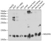 Western blot analysis of extracts of various cell lines, using NDUFA5 antibody (19-235) at 1:1000 dilution.<br/>Secondary antibody: HRP Goat Anti-Rabbit IgG (H+L) at 1:10000 dilution.<br/>Lysates/proteins: 25ug per lane.<br/>Blocking buffer: 3% nonfat dry milk in TBST.<br/>Detection: ECL Basic Kit.<br/>Exposure time: 60s.