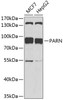 Western blot analysis of extracts of various cell lines, using PARN antibody (19-242) at 1:1000 dilution.<br/>Secondary antibody: HRP Goat Anti-Rabbit IgG (H+L) at 1:10000 dilution.<br/>Lysates/proteins: 25ug per lane.<br/>Blocking buffer: 3% nonfat dry milk in TBST.<br/>Detection: ECL Basic Kit.<br/>Exposure time: 150s.