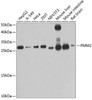 Western blot analysis of extracts of various cell lines, using PMM2 antibody (19-250) at 1:1000 dilution.<br/>Secondary antibody: HRP Goat Anti-Rabbit IgG (H+L) at 1:10000 dilution.<br/>Lysates/proteins: 25ug per lane.<br/>Blocking buffer: 3% nonfat dry milk in TBST.<br/>Detection: ECL Basic Kit.<br/>Exposure time: 60s.