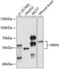 Western blot analysis of extracts of various cell lines, using PRPH antibody (19-256) at 1:1000 dilution.<br/>Secondary antibody: HRP Goat Anti-Rabbit IgG (H+L) at 1:10000 dilution.<br/>Lysates/proteins: 25ug per lane.<br/>Blocking buffer: 3% nonfat dry milk in TBST.<br/>Detection: ECL Basic Kit.<br/>Exposure time: 90s.