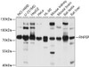 Western blot analysis of extracts of various cell lines, using RNPEP antibody (19-272) at 1:1000 dilution.<br/>Secondary antibody: HRP Goat Anti-Rabbit IgG (H+L) at 1:10000 dilution.<br/>Lysates/proteins: 25ug per lane.<br/>Blocking buffer: 3% nonfat dry milk in TBST.<br/>Detection: ECL Basic Kit.<br/>Exposure time: 5s.