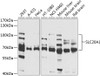 Western blot analysis of extracts of various cell lines, using SLC20A1 antibody (19-284) at 1:1000 dilution.<br/>Secondary antibody: HRP Goat Anti-Rabbit IgG (H+L) at 1:10000 dilution.<br/>Lysates/proteins: 25ug per lane.<br/>Blocking buffer: 3% nonfat dry milk in TBST.<br/>Detection: ECL Basic Kit.<br/>Exposure time: 15s.