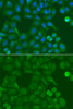 Immunofluorescence analysis of A549 cells using SSX5 antibody (19-288) . Blue: DAPI for nuclear staining.