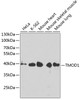 Western blot analysis of extracts of various cell lines, using TMOD1 antibody (19-296) at 1:1000 dilution.<br/>Secondary antibody: HRP Goat Anti-Rabbit IgG (H+L) at 1:10000 dilution.<br/>Lysates/proteins: 25ug per lane.<br/>Blocking buffer: 3% nonfat dry milk in TBST.<br/>Detection: ECL Basic Kit.<br/>Exposure time: 15s.