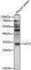 Western blot analysis of extracts of mouse spleen, using UCP2 antibody (19-299) at 1:1000 dilution.<br/>Secondary antibody: HRP Goat Anti-Rabbit IgG (H+L) at 1:10000 dilution.<br/>Lysates/proteins: 25ug per lane.<br/>Blocking buffer: 3% nonfat dry milk in TBST.<br/>Detection: ECL Basic Kit.<br/>Exposure time: 10s.