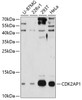 Western blot analysis of extracts of various cell lines, using CDK2AP1 antibody (19-306) at 1:3000 dilution._Secondary antibody: HRP Goat Anti-Rabbit IgG (H+L) at 1:10000 dilution._Lysates/proteins: 25ug per lane._Blocking buffer: 3% nonfat dry milk in TBST._Detection: ECL Enhanced Kit._Exposure time: 90s.