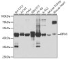 Western blot analysis of extracts of various cell lines, using EIF3G antibody (19-316) at 1:1000 dilution.<br/>Secondary antibody: HRP Goat Anti-Rabbit IgG (H+L) at 1:10000 dilution.<br/>Lysates/proteins: 25ug per lane.<br/>Blocking buffer: 3% nonfat dry milk in TBST.<br/>Detection: ECL Basic Kit.<br/>Exposure time: 1s.
