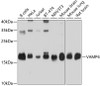 Western blot analysis of extracts of various cell lines, using VAMP4 antibody (19-317) at 1:1000 dilution.<br/>Secondary antibody: HRP Goat Anti-Rabbit IgG (H+L) at 1:10000 dilution.<br/>Lysates/proteins: 25ug per lane.<br/>Blocking buffer: 3% nonfat dry milk in TBST.<br/>Detection: ECL Basic Kit.<br/>Exposure time: 10s.