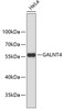 Western blot analysis of extracts of HeLa cells, using GALNT4 antibody (19-318) .<br/>Secondary antibody: HRP Goat Anti-Rabbit IgG (H+L) at 1:10000 dilution.<br/>Lysates/proteins: 25ug per lane.<br/>Blocking buffer: 3% nonfat dry milk in TBST.