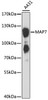 Western blot analysis of extracts of A-431 cells, using MAP7 antibody (19-324) at 1:3000 dilution.<br/>Secondary antibody: HRP Goat Anti-Rabbit IgG (H+L) at 1:10000 dilution.<br/>Lysates/proteins: 25ug per lane.<br/>Blocking buffer: 3% nonfat dry milk in TBST.<br/>Detection: ECL Basic Kit.<br/>Exposure time: 90s.