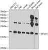 Western blot analysis of extracts of various cell lines, using EIF1AY antibody (19-325) at 1:1000 dilution.<br/>Secondary antibody: HRP Goat Anti-Rabbit IgG (H+L) at 1:10000 dilution.<br/>Lysates/proteins: 25ug per lane.<br/>Blocking buffer: 3% nonfat dry milk in TBST.<br/>Detection: ECL Enhanced Kit.<br/>Exposure time: 90s.