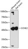 Western blot analysis of extracts of various cell lines, using CCNE2 antibody (19-327) at 1:3000 dilution.<br/>Secondary antibody: HRP Goat Anti-Rabbit IgG (H+L) at 1:10000 dilution.<br/>Lysates/proteins: 25ug per lane.<br/>Blocking buffer: 3% nonfat dry milk in TBST.<br/>Detection: ECL Enhanced Kit.<br/>Exposure time: 90s.