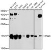 Western blot analysis of extracts of various cell lines, using RPL23 antibody (19-331) at 1:1000 dilution.<br/>Secondary antibody: HRP Goat Anti-Rabbit IgG (H+L) at 1:10000 dilution.<br/>Lysates/proteins: 25ug per lane.<br/>Blocking buffer: 3% nonfat dry milk in TBST.<br/>Detection: ECL Basic Kit.<br/>Exposure time: 5s.