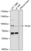 Western blot analysis of extracts of various cell lines, using PLAA antibody (19-333) at 1:1000 dilution.<br/>Secondary antibody: HRP Goat Anti-Rabbit IgG (H+L) at 1:10000 dilution.<br/>Lysates/proteins: 25ug per lane.<br/>Blocking buffer: 3% nonfat dry milk in TBST.<br/>Detection: ECL Basic Kit.<br/>Exposure time: 10s.
