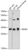 Western blot analysis of extracts of various cell lines, using EIF4E2 antibody (19-336) at 1:1000 dilution.<br/>Secondary antibody: HRP Goat Anti-Rabbit IgG (H+L) at 1:10000 dilution.<br/>Lysates/proteins: 25ug per lane.<br/>Blocking buffer: 3% nonfat dry milk in TBST.<br/>Detection: ECL Basic Kit.<br/>Exposure time: 90s.