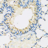 Immunohistochemistry of paraffin-embedded mouse lung using ABCF2 antibody (19-352) at dilution of 1:100 (40x lens) .