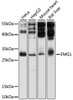 Western blot analysis of extracts of various cell lines, using EMG1 antibody (19-364) at 1:1000 dilution.<br/>Secondary antibody: HRP Goat Anti-Rabbit IgG (H+L) at 1:10000 dilution.<br/>Lysates/proteins: 25ug per lane.<br/>Blocking buffer: 3% nonfat dry milk in TBST.<br/>Detection: ECL Basic Kit.<br/>Exposure time: 1s.