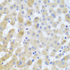 Immunohistochemistry of paraffin-embedded human liver damage using EIF3M antibody (19-365) at dilution of 1:100 (40x lens) .