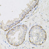 Immunohistochemistry of paraffin-embedded human prostate using CIB1 antibody (19-368) at dilution of 1:100 (40x lens) .
