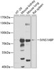 Western blot analysis of extracts of various cell lines, using IVNS1ABP antibody (19-371) at 1:1000 dilution.<br/>Secondary antibody: HRP Goat Anti-Rabbit IgG (H+L) at 1:10000 dilution.<br/>Lysates/proteins: 25ug per lane.<br/>Blocking buffer: 3% nonfat dry milk in TBST.<br/>Detection: ECL Basic Kit.<br/>Exposure time: 30s.