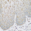 Immunohistochemistry of paraffin-embedded human esophagus using IGF2BP3 antibody (19-372) at dilution of 1:200 (40x lens) .