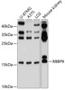 Western blot analysis of extracts of various cell lines, using RBBP9 antibody (19-377) at 1:1000 dilution.<br/>Secondary antibody: HRP Goat Anti-Rabbit IgG (H+L) at 1:10000 dilution.<br/>Lysates/proteins: 25ug per lane.<br/>Blocking buffer: 3% nonfat dry milk in TBST.<br/>Detection: ECL Basic Kit.<br/>Exposure time: 10s.