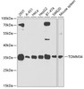 Western blot analysis of extracts of various cell lines, using TOMM34 antibody (19-385) at 1:1000 dilution._Secondary antibody: HRP Goat Anti-Rabbit IgG (H+L) at 1:10000 dilution._Lysates/proteins: 25ug per lane._Blocking buffer: 3% nonfat dry milk in TBST._Detection: ECL Enhanced Kit._Exposure time: 90s.