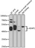 Western blot analysis of extracts of various cell lines, using ADAP1 antibody (19-390) at 1:1000 dilution.<br/>Secondary antibody: HRP Goat Anti-Rabbit IgG (H+L) at 1:10000 dilution.<br/>Lysates/proteins: 25ug per lane.<br/>Blocking buffer: 3% nonfat dry milk in TBST.<br/>Detection: ECL Basic Kit.<br/>Exposure time: 30s.