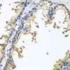 Immunohistochemistry of paraffin-embedded human prostate using NLGN4Y antibody (19-401) at dilution of 1:100 (40x lens) .