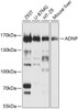 Western blot analysis of extracts of various cell lines, using ADNP Antibody (19-410) at 1:1000 dilution.<br/>Secondary antibody: HRP Goat Anti-Rabbit IgG (H+L) at 1:10000 dilution.<br/>Lysates/proteins: 25ug per lane.<br/>Blocking buffer: 3% nonfat dry milk in TBST.<br/>Detection: ECL Basic Kit.<br/>Exposure time: 10s.