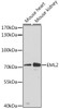 Western blot analysis of extracts of various cell lines, using EML2 antibody (19-417) at 1:3000 dilution.<br/>Secondary antibody: HRP Goat Anti-Rabbit IgG (H+L) at 1:10000 dilution.<br/>Lysates/proteins: 25ug per lane.<br/>Blocking buffer: 3% nonfat dry milk in TBST.<br/>Detection: ECL Basic Kit.<br/>Exposure time: 90s.
