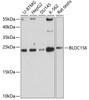 Western blot analysis of extracts of various cell lines, using BLOC1S6 antibody (19-429) at 1:1000 dilution.<br/>Secondary antibody: HRP Goat Anti-Rabbit IgG (H+L) at 1:10000 dilution.<br/>Lysates/proteins: 25ug per lane.<br/>Blocking buffer: 3% nonfat dry milk in TBST.<br/>Detection: ECL Basic Kit.<br/>Exposure time: 30s.
