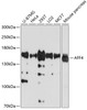 Western blot analysis of extracts of various cell lines, using AFF4 antibody (19-432) at 1:1000 dilution._Secondary antibody: HRP Goat Anti-Rabbit IgG (H+L) at 1:10000 dilution._Lysates/proteins: 25ug per lane._Blocking buffer: 3% nonfat dry milk in TBST._Detection: ECL Basic Kit._Exposure time: 30s.