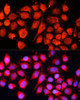 Immunofluorescence analysis of HeLa cells using MRPS28 Polyclonal Antibody (19-437) at dilution of 1:100 (40x lens) . Blue: DAPI for nuclear staining.