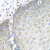 Immunohistochemistry of paraffin-embedded human esophagus using TMOD3 antibody (19-441) at dilution of 1:100 (40x lens) .