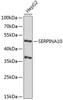 Western blot analysis of extracts of HepG2 cells, using SERPINA10 antibody (19-451) at 1:1000 dilution.<br/>Secondary antibody: HRP Goat Anti-Rabbit IgG (H+L) at 1:10000 dilution.<br/>Lysates/proteins: 25ug per lane.<br/>Blocking buffer: 3% nonfat dry milk in TBST.<br/>Detection: ECL Basic Kit.<br/>Exposure time: 120s.