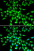 Immunofluorescence analysis of A549 cells using SERPINA10 antibody (19-451) . Blue: DAPI for nuclear staining.